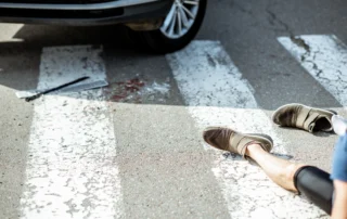 Injured pedestrian lying on a crosswalk beside a vehicle tire with a crutch nearby, illustrating the serious consequences of a pedestrian accident and the pursuit of injury compensation claims in Louisiana.